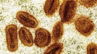 Mpox and Marburg Virus Outbreaks Strain Central and East Africa's Health Systems 